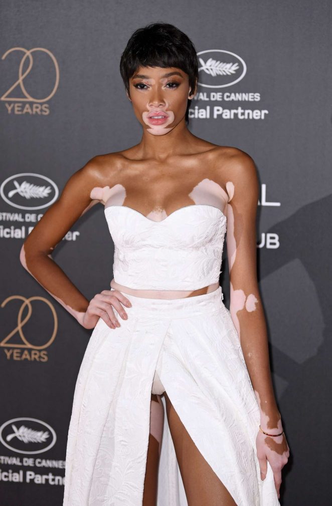 Winnie Harlow - L'Oreal 20th Anniversary Party in Cannes